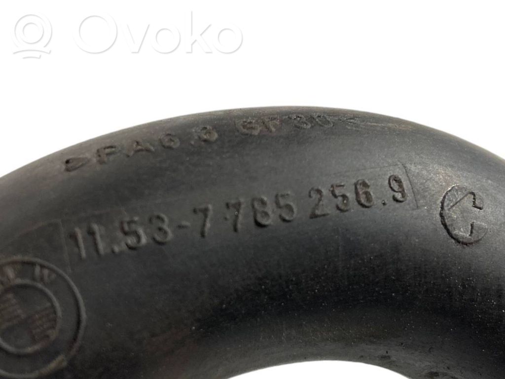 Caurulīte (-es) / šļūtene (-es)