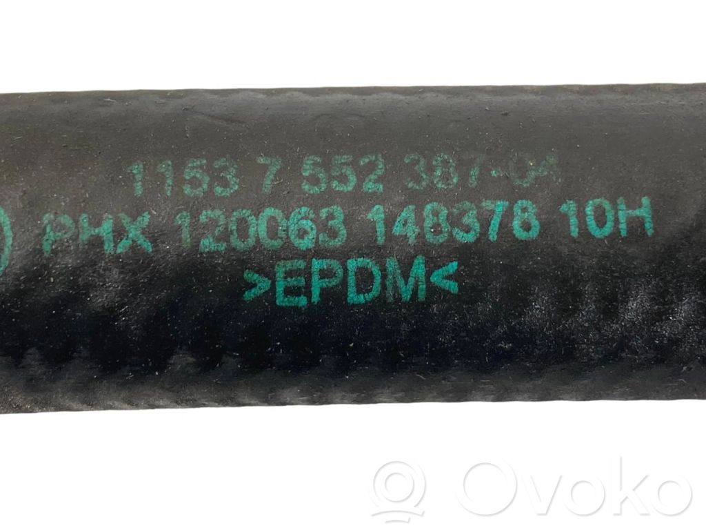 Caurulīte (-es) / šļūtene (-es)