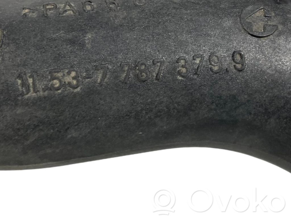 Caurulīte (-es) / šļūtene (-es)