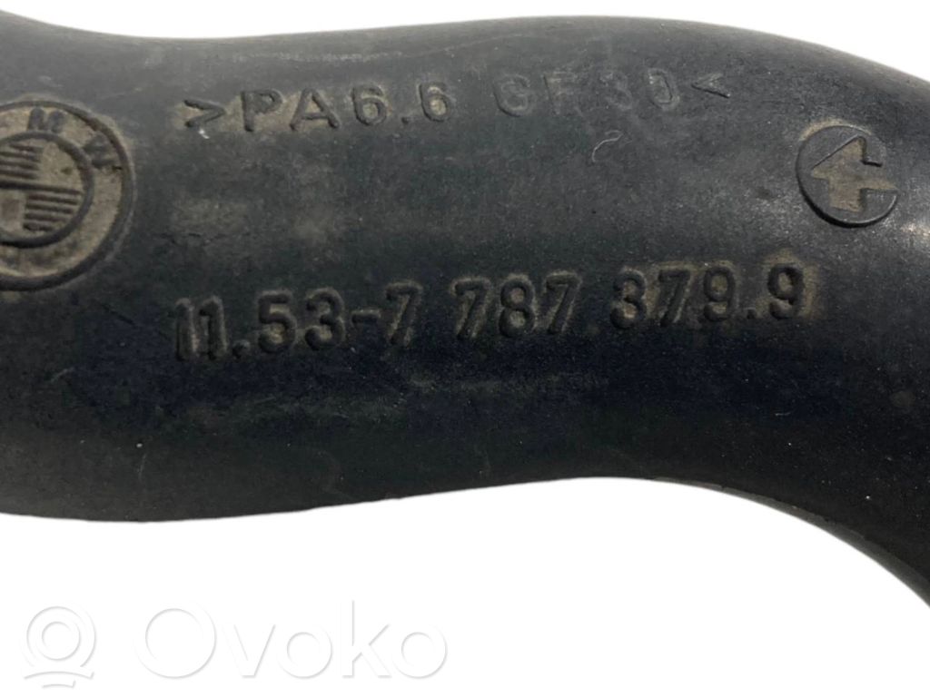 Caurulīte (-es) / šļūtene (-es)