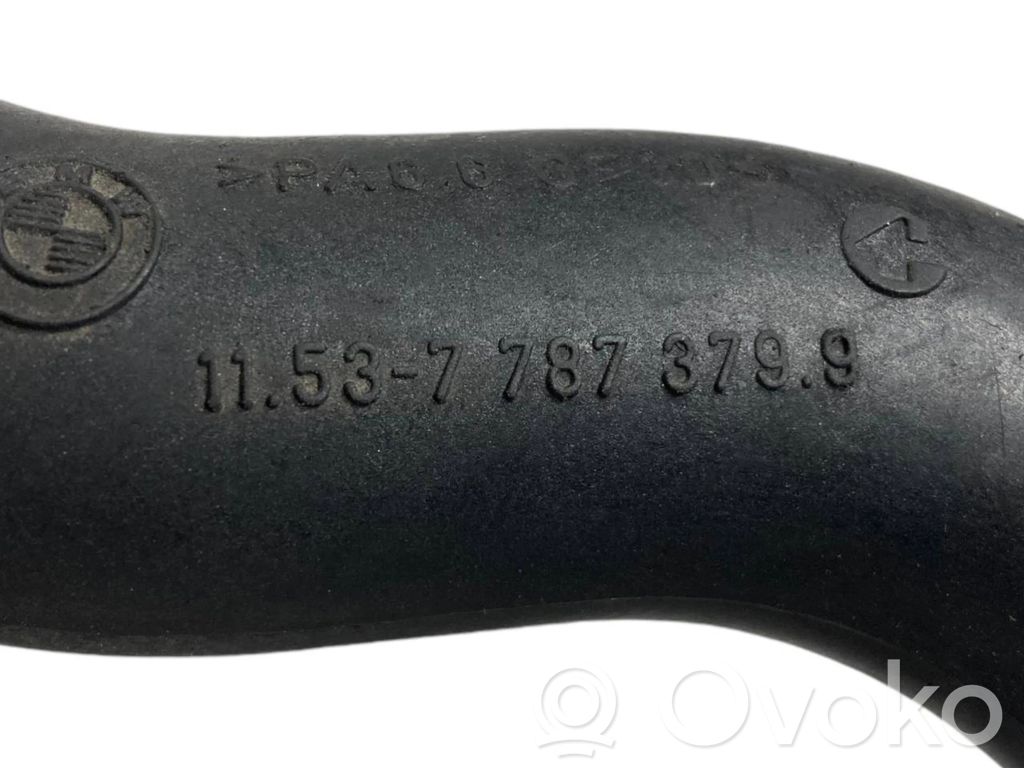 Caurulīte (-es) / šļūtene (-es)