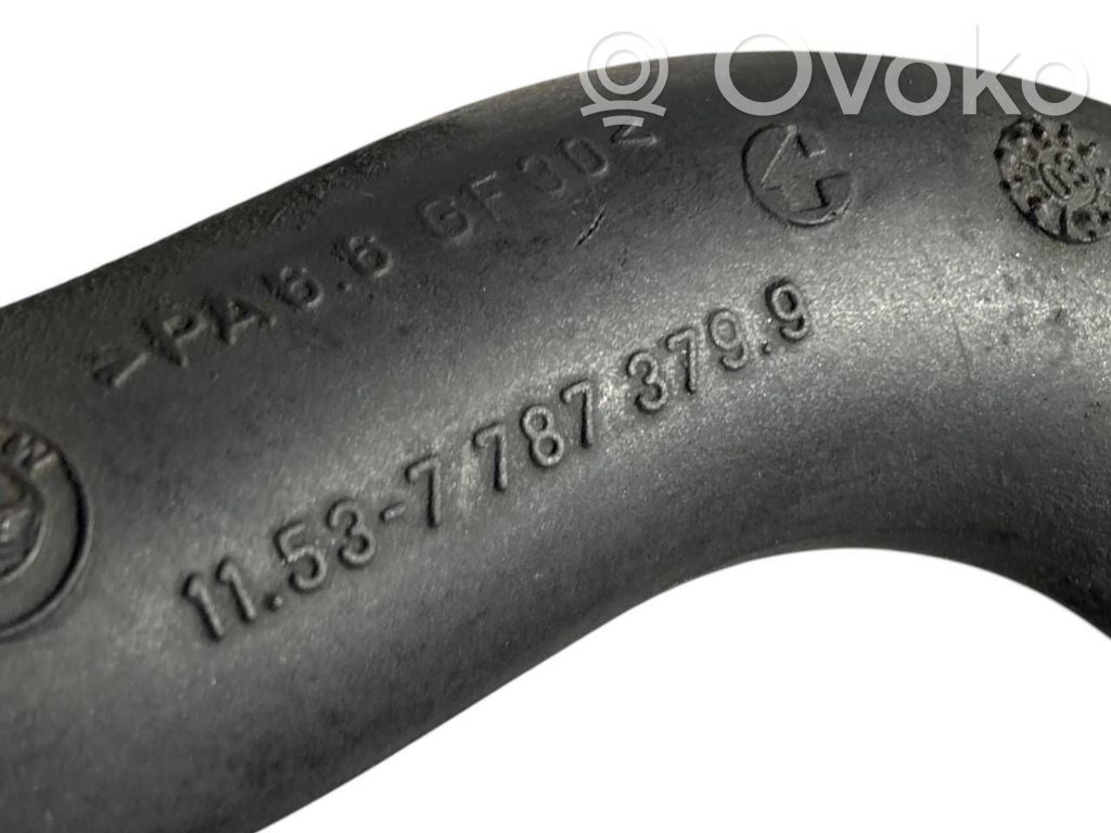 Caurulīte (-es) / šļūtene (-es)