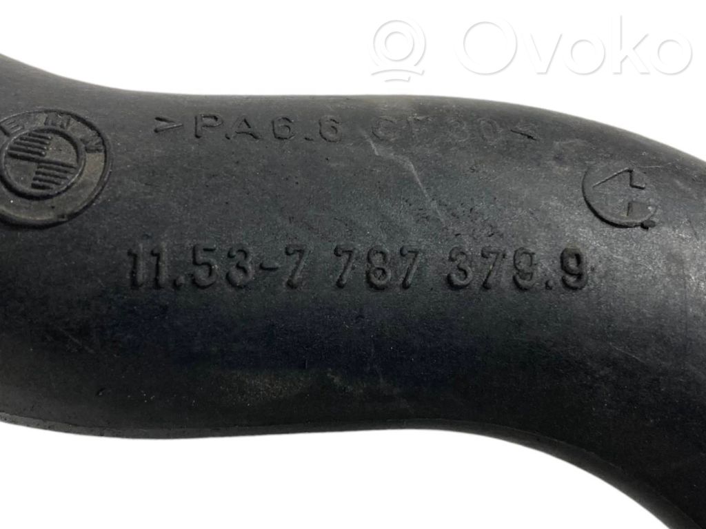 Caurulīte (-es) / šļūtene (-es)