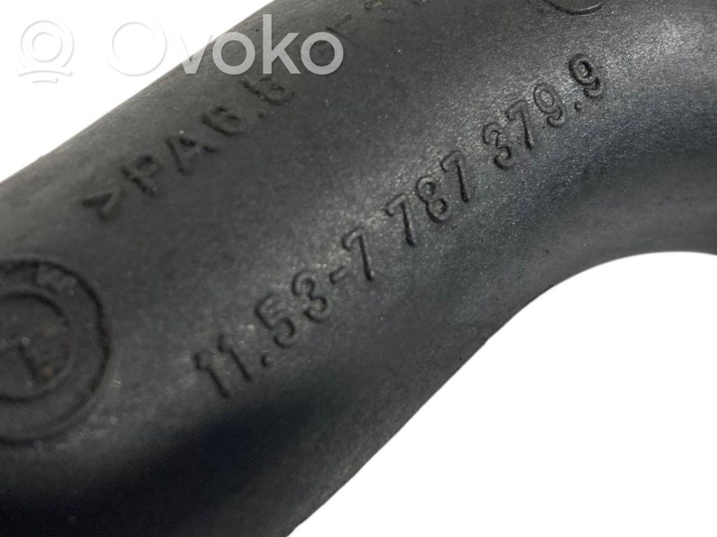 Caurulīte (-es) / šļūtene (-es)