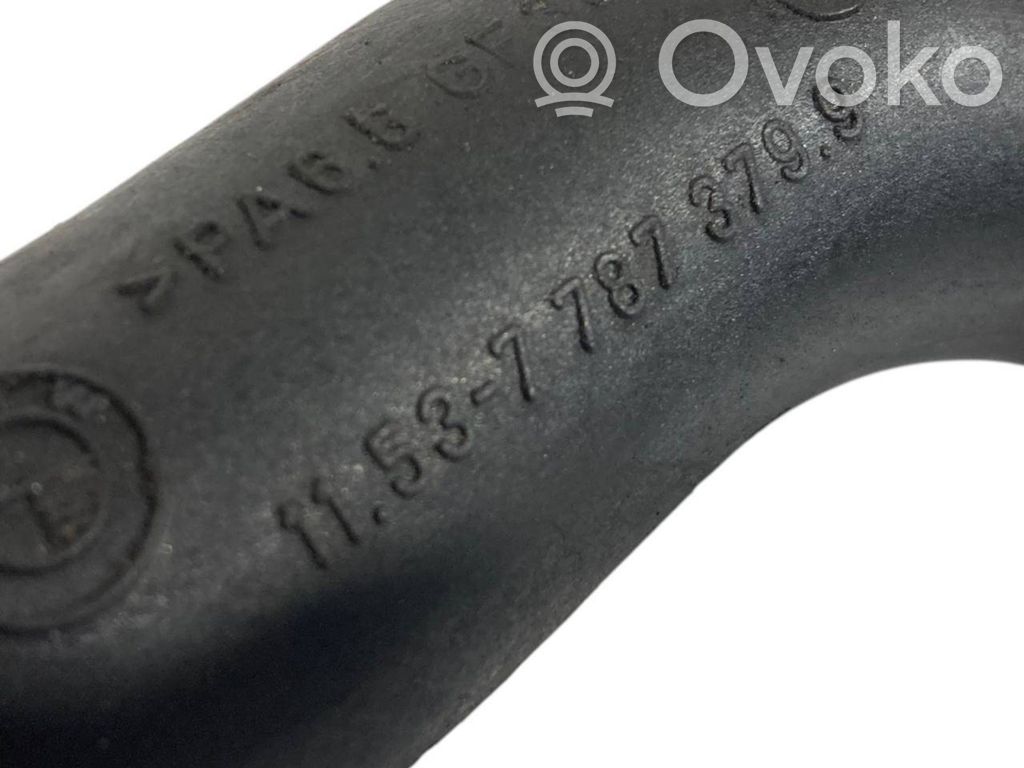 Caurulīte (-es) / šļūtene (-es)