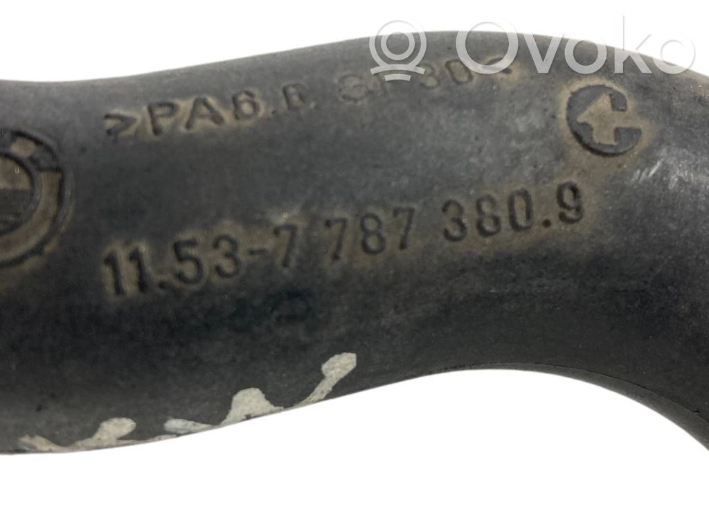 Caurulīte (-es) / šļūtene (-es)