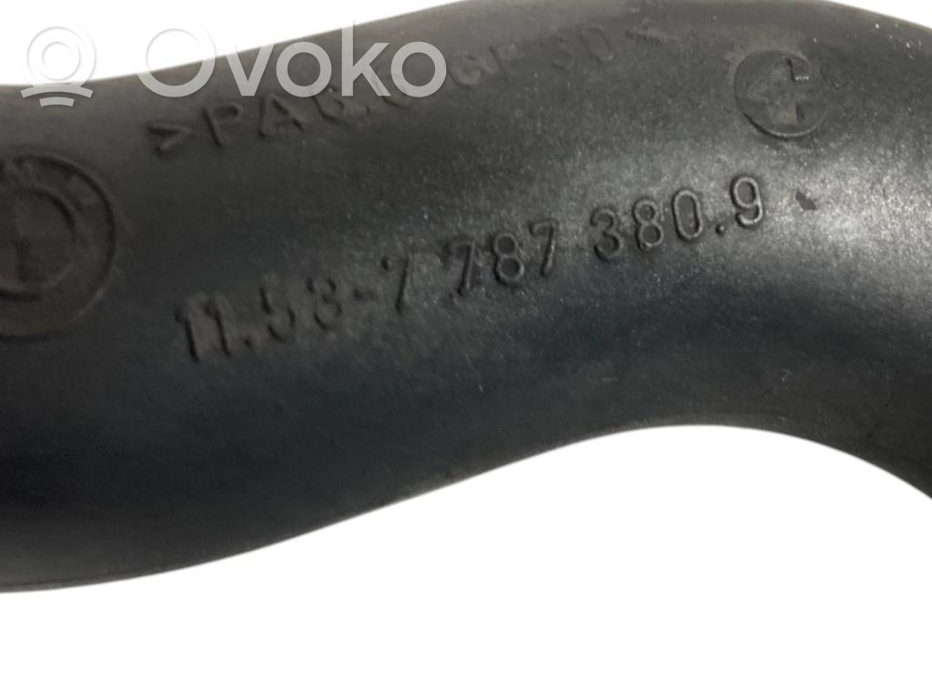 Caurulīte (-es) / šļūtene (-es)