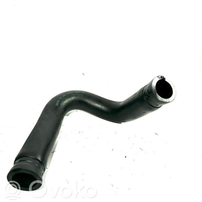 Caurulīte (-es) / šļūtene (-es)