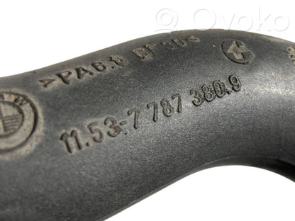 Caurulīte (-es) / šļūtene (-es)