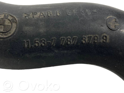 Caurulīte (-es) / šļūtene (-es)