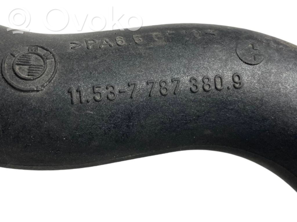 Caurulīte (-es) / šļūtene (-es)