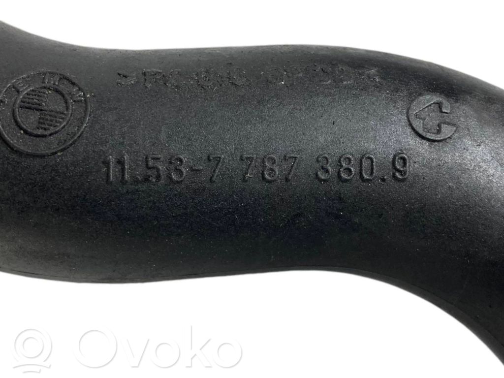 Caurulīte (-es) / šļūtene (-es)