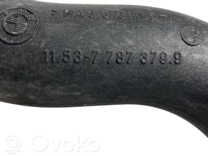 Caurulīte (-es) / šļūtene (-es)